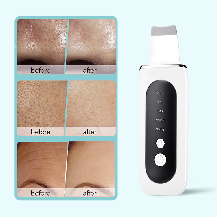 Pro Ultrasonic Facial Scrubber - Pore Cleaner Blackhead Remover Skin Rejuvenation Tool